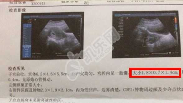 借卵代生生子内膜要求,杭州省妇保试管成功率被作息影响？