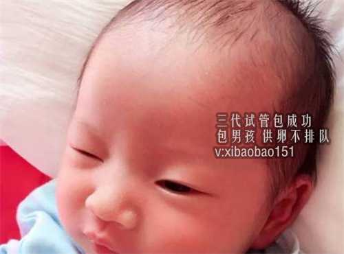 借卵代生生孩子多少钱,北京试管婴儿成功率高吗 促排期间怎样配合