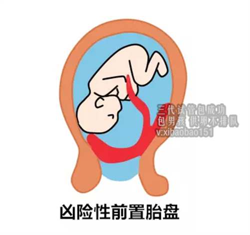 南京代孕产子公司安全吗,桂林精子库没有精子吗